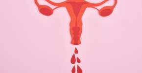 Conheça as causas da irregularidade menstrual
