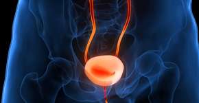 Hábito alimentar comum aumenta risco de câncer de bexiga; saiba qual