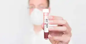 Cientistas conseguem curar HIV em animais vivos pela primeira vez