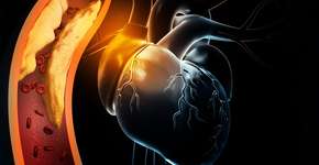 Fruta popular na mesa dos brasileiros reduz colesterol e previne câncer