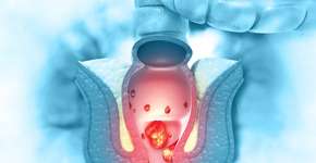 Esse hábito no vaso pode causar hemorroida e você nem desconfia