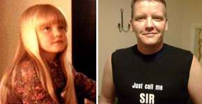 Homem trans ganha pênis construído a partir de tecido do seu próprio antebraço