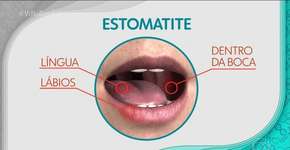 Foto: (Imagem sem texto alternativo disponivel ID [1849675])