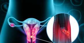 Foto: (iStock/Mohammed Haneefa Nizamudeen)