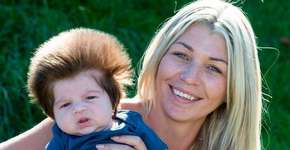 Lembra dele? Veja como está Cox, o ‘bebê mais cabeludo do mundo’