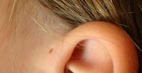 Foto: (Imagem sem texto alternativo disponivel ID [1383637])