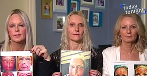 Laser deixa mulheres com queimaduras de terceiro grau no rosto