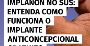 Implanon será oferecido pelo SUS: veja como funciona o anticoncepcional gratuito