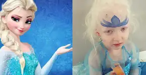 Como a princesa Elsa ajudou uma garotinha a aceitar seu albinismo