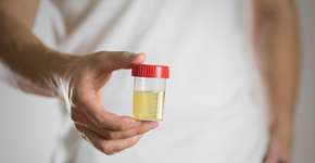 Foto: (Viktoriya Kuzmenkova/istock)