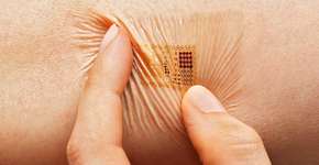 Foto: (Imagem sem texto alternativo disponivel ID [1828302])