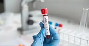 Entenda os sinais iniciais de infecção pelo HIV e o que fazer quando tiver o diagnóstico