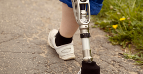 Descobriram que o cérebro mantém o mapa dos membros amputados