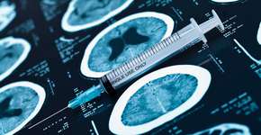 Vacina contra Alzheimer dá mais um passo que pode revolucionar o tratamento