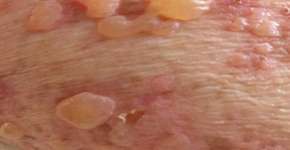 Foto: (PS3000/istock)