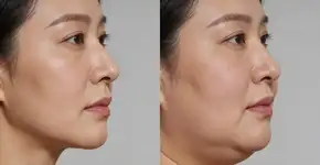 Foto: (Imagem sem texto alternativo disponivel ID [2680232])