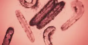 Foto: (narvikk/istock)