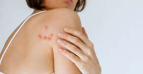 Foto: (iStock/Marija Bazarova)