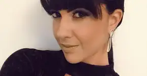 Graciele Lacerda compartilha tratamento estético em rede social