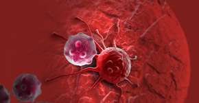 O que significa ter um câncer em estágio 4? Saiba mais