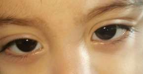 Foto: (Imagem sem texto alternativo disponivel ID [1542690])