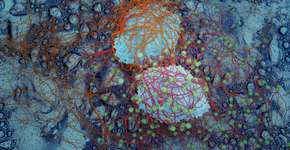 Foto: (nopparit/istock)