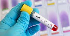 Novo estudo traz avanço promissor na busca pela cura do HIV