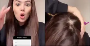 Ex-BBB Eslovênia descobre doença autoimune; conheça os sinais