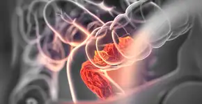 Estudo indica quais alimentos ajudam a evitar câncer de intestino