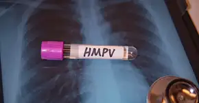 Foto: (JUN LI/istock)