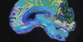 O hábito simples que reduz o risco de demência e só leva cerca de 2 horas por dia