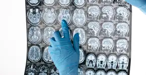 Foto: (SergIllin/DepositPhotos)