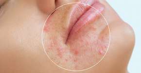 Foto: (Getty Images/iStockphoto)