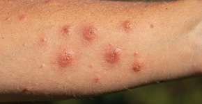 Foto: (Imagem sem texto alternativo disponivel ID [2689987])