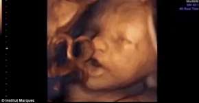 Vídeo mostra feto ‘cantando’ dentro da barriga de mãe