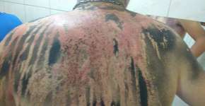 Foto: (Imagem sem texto alternativo disponivel ID [1034291])