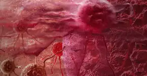 Foto: (vitanovski/istock)