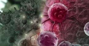 Foto: (Depositphotos/vitanovski)