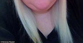 Jovem de 203 kg conta sua história através de diário de fotos