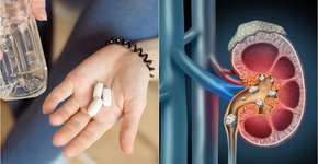 Quando a pele e os músculos avisam: sinais ocultos da deficiência de cálcio