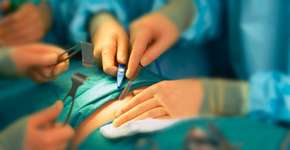 Redução de estômago: saiba mais e entenda quando é preciso fazer