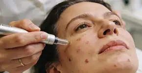 Foto: (Imagem sem texto alternativo disponivel ID [2712379])