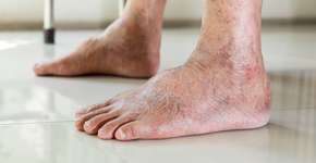 Foto: (iStock/Satjawat Boontanataweepol)