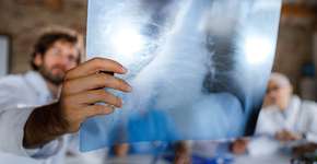 Foto: (skynesher/istock)