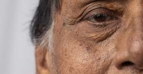 Descoberto medicamento que pode reduzir risco de Alzheimer