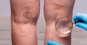 Foto: (AndreyPopov/istock)