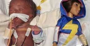 Bebê que nasceu menor que uma Barbie sobrevive e chega aos 7 kg