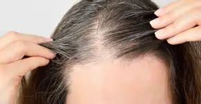 Descoberto o fator que dobra o risco de fios brancos antes dos 30