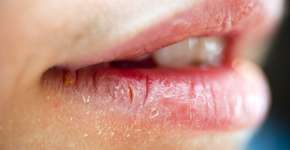 Foto: (wakila/istock)