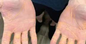 Foto: (divulgação/ JAMA)